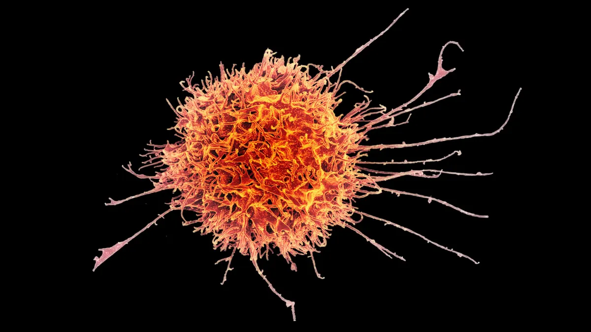 Colorized scanning electron micrograph of a natural killer cell from a human donor.
