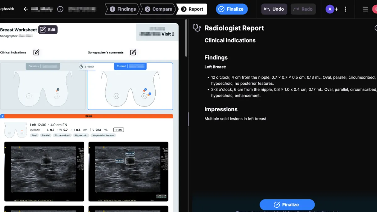 Images on the left side of a screen show tissue from a breast ultrasound, while the right screen shows a radiologist report with findings written out.